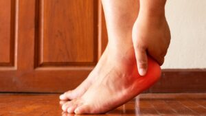 Fascite Plantar
